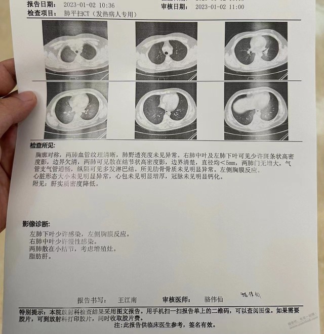 阳了之后一直咳嗽去拍了CT