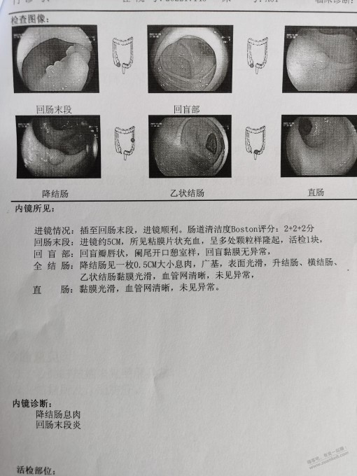 年前的体检单，这个肠息肉需要做手术吗？