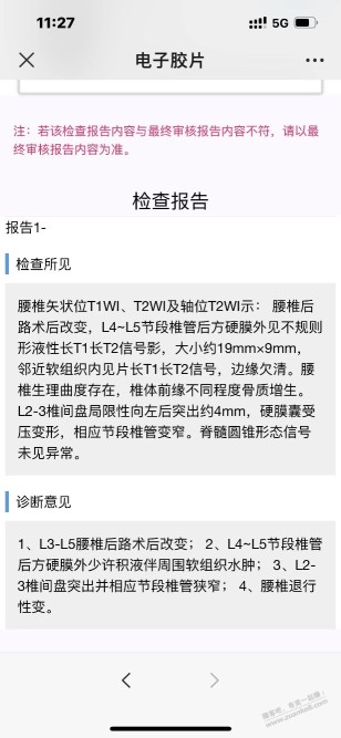 北京暂时去不了了，济南跟青岛，哪个医院脊柱外科比较好，腰间盘二次手术