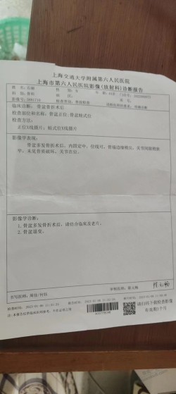 有老哥懂骨科嘛  不是德国骨科