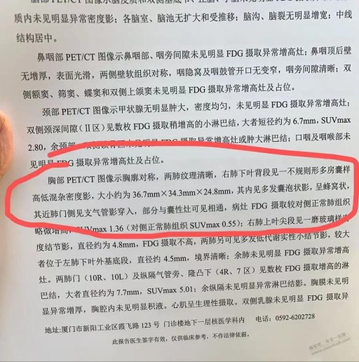 各位帮我看下岳母的检查报告，是否要做穿刺